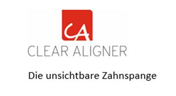 Clear Aligner - Die unsichtbare Zahnspange